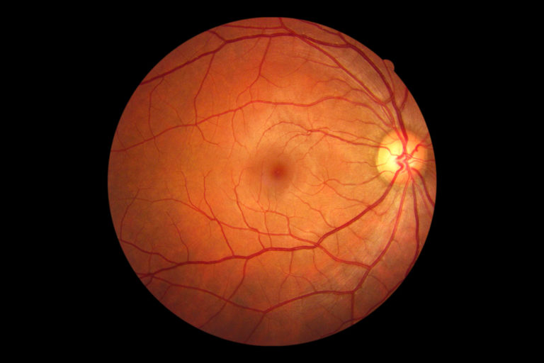 Photo of Retina