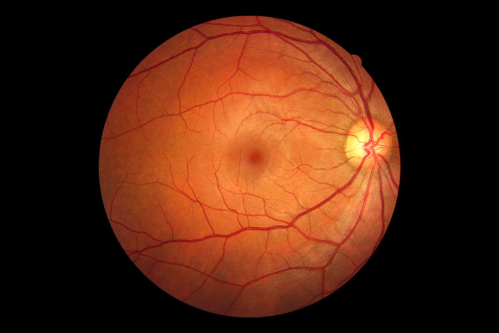 Photo of Retina